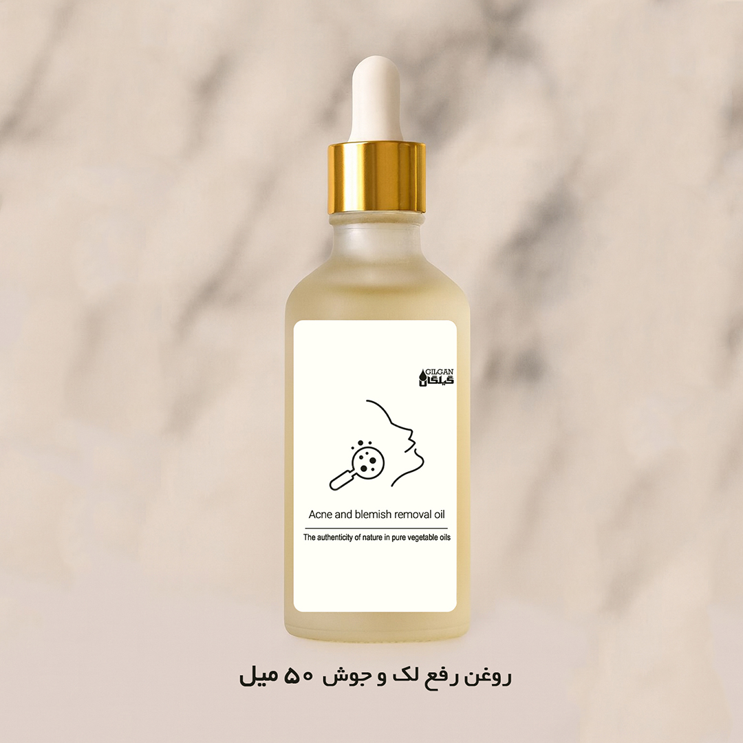 روغن رفع لک و جوش